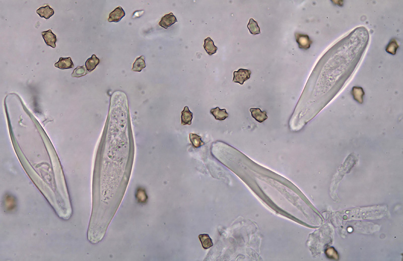 Inocybe percastanea spores hymenial cystidia Inocybe percastanea spory cystidy